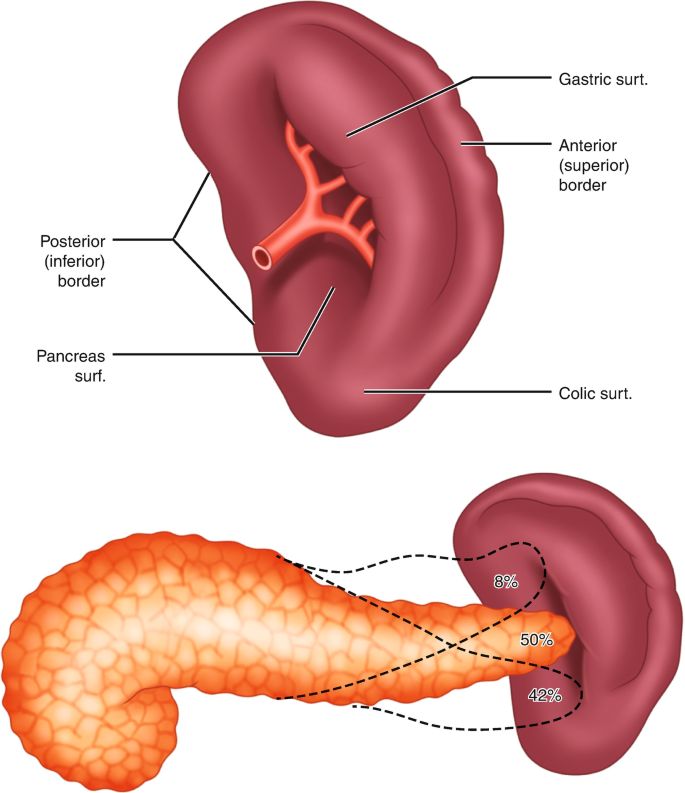 Spleen Removal